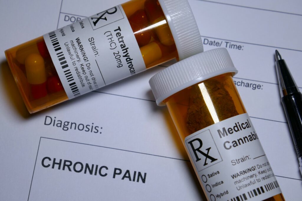 Cannabis Strains for Pain and Inflammation